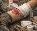 A person applying a bandage to a bleeding leg, demonstrating essential first aid skills for survival preparedness.