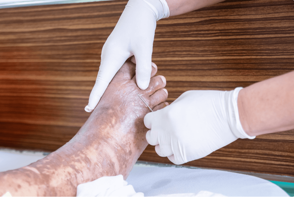 Burn First Aid Made Simple: How to Use Burn Gel Dressings Effectively in the Outdoors