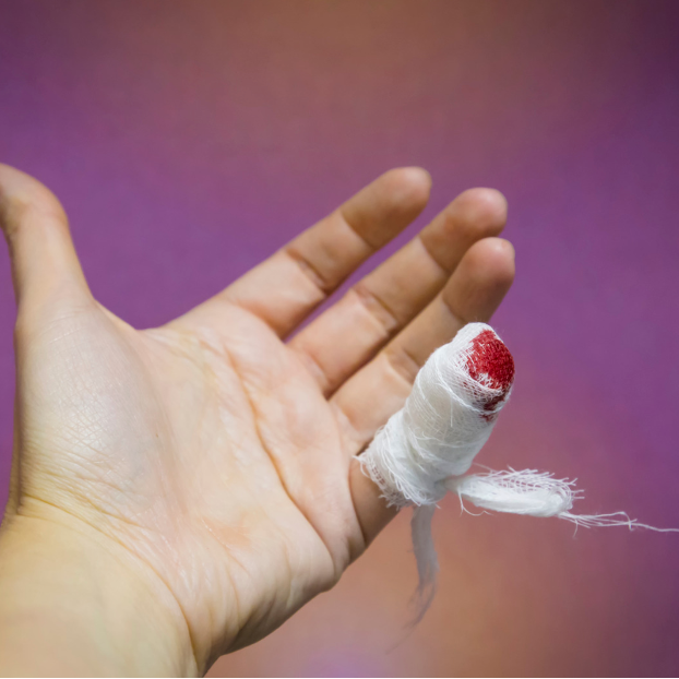 The Quick Fix for Bleeding - Understanding Hemostatic Gauze Dressing