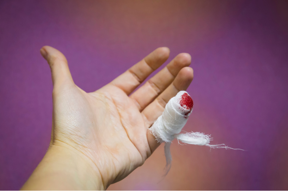 The Quick Fix for Bleeding - Understanding Hemostatic Gauze Dressing