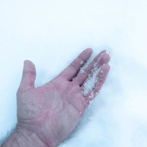 A Winter Hiker's Guide to Recognizing and Addressing Frostbite: close-up of a hand in snow.