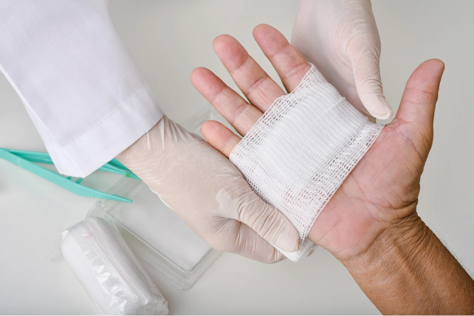 A Guide to Using Conforming Gauze - Tips for Effective Bandaging