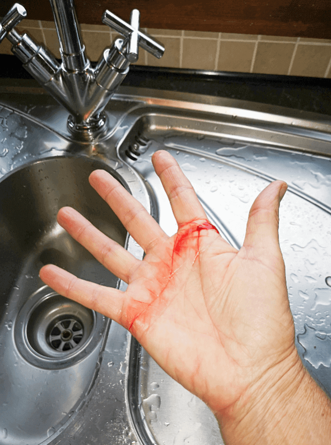 Wound closure techniques guide showing a bleeding hand injury near a sink.