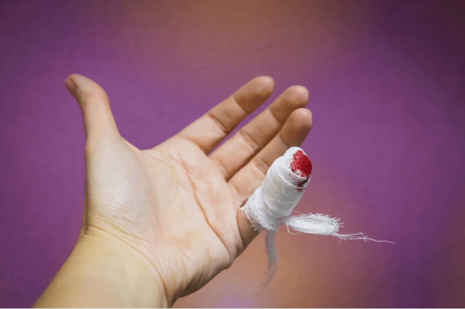 A pinky finger wrapped in hemostatic gauze